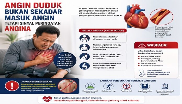 Angin Duduk Angin Duduk